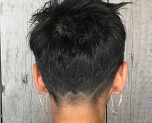 Dandruff Vs Dry Scalp