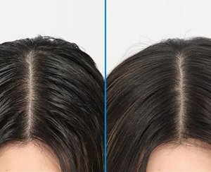 reasons for oily scalp